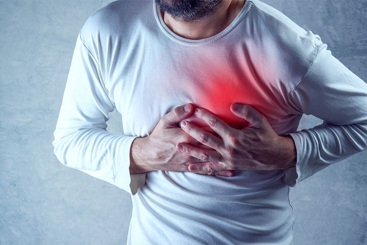 Chest Pain image