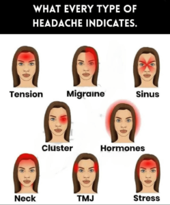 Headaches