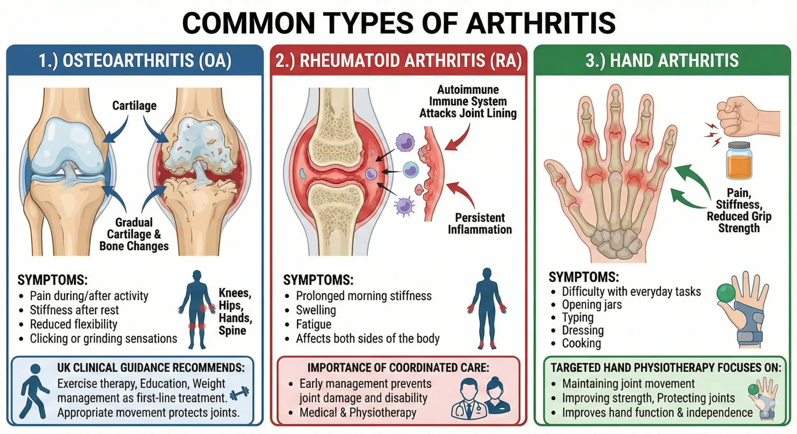 Common types of arthritis diagram showing osteoarthritis, rheumatoid arthritis, and hand arthritis, including joint inflammation, cartilage changes, symptoms, and areas affected.